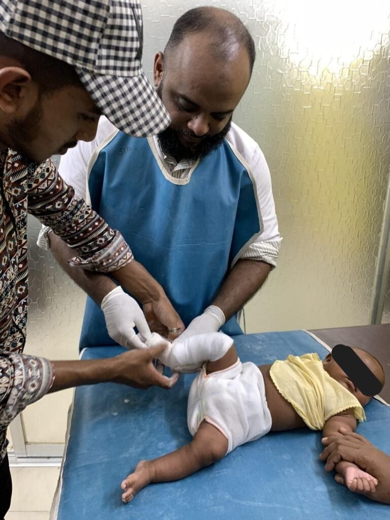 Walf for Life physio treating clubfoot patient